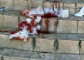 Καβάλα: Έκανε απόπειρα αυτοκτονίας και κάλεσε ο ίδιος σε βοήθεια για να μεταφερθεί στο νοσοκομείο