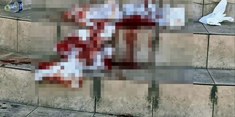 Alldaynews.gr Καβάλα: Έκανε απόπειρα αυτοκτονίας και κάλεσε ο ίδιος σε βοήθεια για να μεταφερθεί στο νοσοκομείο