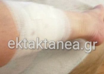 Αγέλη σκύλων επιτέθηκε σε γυναίκα στο Λιμάνι Θεσσαλονίκης[photos]