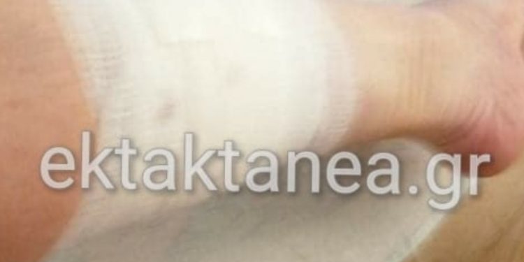 Αγέλη σκύλων επιτέθηκε σε γυναίκα στο Λιμάνι Θεσσαλονίκης[photos]