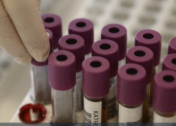 Σάλος με νέα σύμβαση εργασίας – Προβλέπει λήψη δειγμάτων σάλιου και αίματος