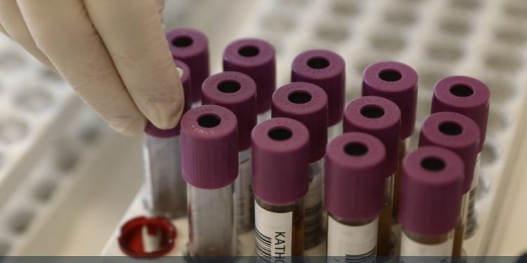 Σάλος με νέα σύμβαση εργασίας – Προβλέπει λήψη δειγμάτων σάλιου και αίματος