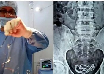 30χρονος είχε Παθητική Σ3Χουαλική επαφή με φορτιστή κινητού τηλεφώνου![photos]