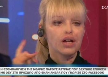 Η εξομολόγηση στην Τατιάνα για την επίθεση με οξύ που δέχτηκε στο πρόσωπο στα 24 χρόνια της – Πώς είναι η ζωή της σήμερα;