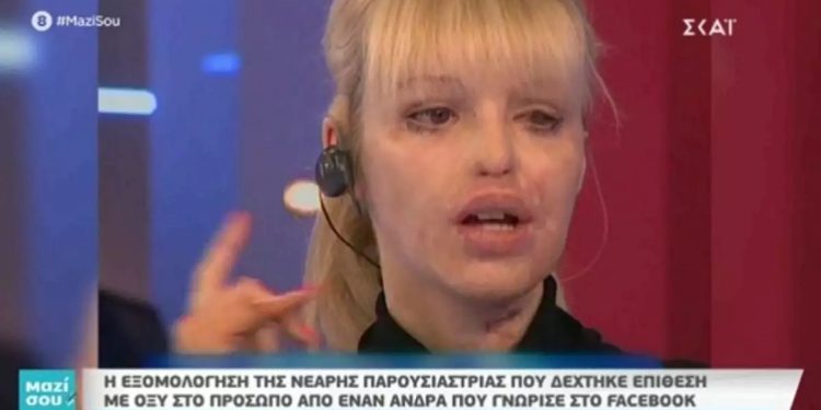 Alldaynews.gr Η εξομολόγηση στην Τατιάνα για την επίθεση με οξύ που δέχτηκε στο πρόσωπο στα 24 χρόνια της – Πώς είναι η ζωή της σήμερα;