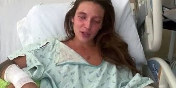 Βοηθήστε μας να σώσουμε τα μάτια της Marta. Προσπάθησε να φτιάξει καλλυντικά και τυφλώθηκε