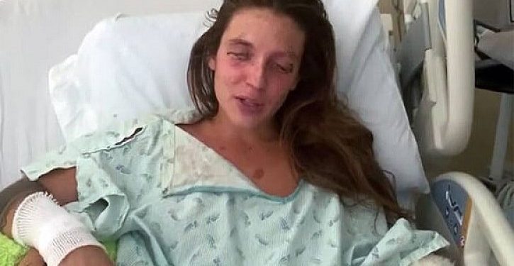 Βοηθήστε μας να σώσουμε τα μάτια της Marta. Προσπάθησε να φτιάξει καλλυντικά και τυφλώθηκε