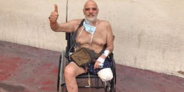 Alldaynews.gr Ακρωτηριάστηκε στο πόδι ο ηθοποιός Γιώργος Βούρος