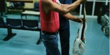 Alldaynews.gr Τον δάγκωσε φίδι και το πήρε μαζί του στο Κέντρο Υγείας!