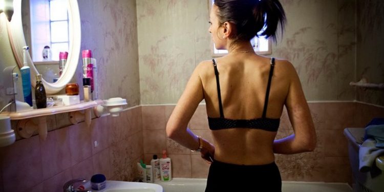 Οι Γαλλίδες πέταξαν τα σουτιέν! Το στήθος εγκλωβίζεται για να δείχνει στητό!