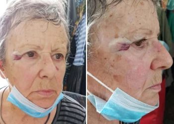 Εύβοια: Ιερέας επιτέθηκε και χτύπησε ηλικιωμένη με σκουπόξυλο επειδή τάιζε τα αδέσποτα της γειτονιάς 