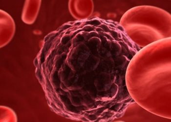 Σε ποια περιοχή της Ελλάδας θερίζει ο καρκίνος. Ποιοι οι κίνδυνοι, τι να προσέχετε