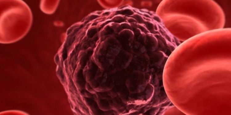 Alldaynews.gr Σε ποια περιοχή της Ελλάδας θερίζει ο καρκίνος. Ποιοι οι κίνδυνοι, τι να προσέχετε