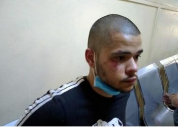 Σημάδια ξυλοδαρμού φέρει ο Κώστας, ο νεαρός διαδηλωτής που συνελήφθη-Πέρασε και Νομική!