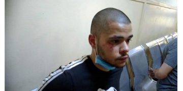 Alldaynews.gr Σημάδια ξυλοδαρμού φέρει ο Κώστας, ο νεαρός διαδηλωτής που συνελήφθη-Πέρασε και Νομική!