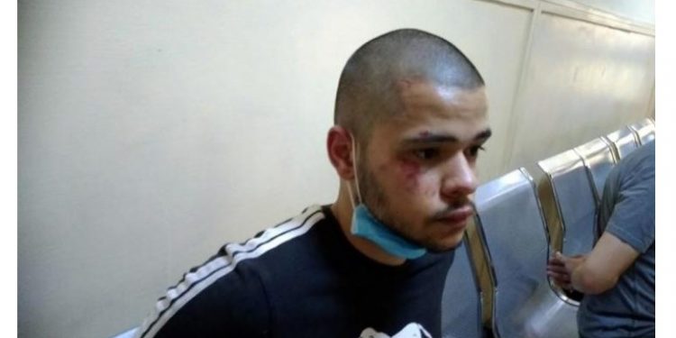 Alldaynews.gr Σημάδια ξυλοδαρμού φέρει ο Κώστας, ο νεαρός διαδηλωτής που συνελήφθη-Πέρασε και Νομική!