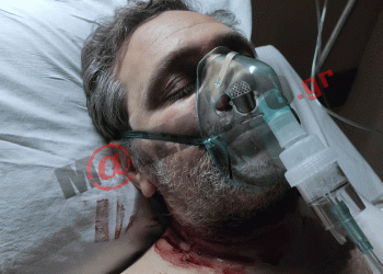 Νέα στοιχεία για την απόπειρα δολοφονίας του Στέφανου Χίου – ΕΙΚΟΝΕΣ ΠΟΥ ΣΟΚΑΡΟΥΝ