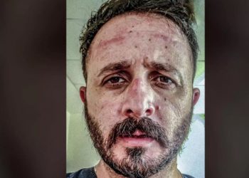 Καταπέλτης γιατρός του ΠΑΓΝΗ: Γκρινιάζετε για τις μάσκες κι εμείς δεν έχουμε!