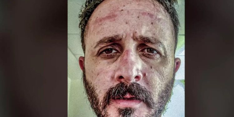 Alldaynews.gr Καταπέλτης γιατρός του ΠΑΓΝΗ: Γκρινιάζετε για τις μάσκες κι εμείς δεν έχουμε!