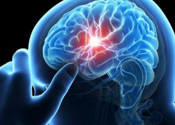 Ένα μήνα πριν το εγκεφαλικό το σώμα σου θα σου στείλει αυτά τα σημάδια – Μην τα αγνοήσεις