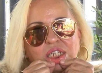 Μπέσσυ Αργυράκη: Έβαλε σιδεράκι στα δόντια στα 63 της!