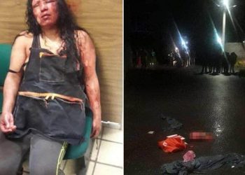 Μετά από σατανιστική τελετή πέταξε στο δρόμο το κομμένο κεφάλι του φίλου της