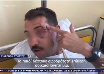 Άγριος ξυλοδαρμός 33χρονου για ένα κινητό – Θρυμματισμένα οστά προσώπου σε κατάσταση σοκ συγκλονίζει με την μαρτυρία του