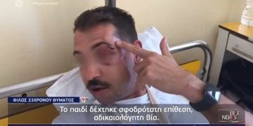 Alldaynews.gr Άγριος ξυλοδαρμός 33χρονου για ένα κινητό – Θρυμματισμένα οστά προσώπου σε κατάσταση σοκ συγκλονίζει με την μαρτυρία του