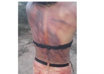 Μαστίγωσαν άγρια τρανς και κατέγραψαν σε βίντεο τη φρικαλεότητα