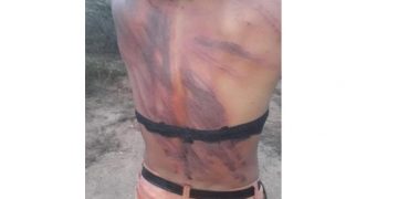 Alldaynews.gr Μαστίγωσαν άγρια τρανς και κατέγραψαν σε βίντεο τη φρικαλεότητα