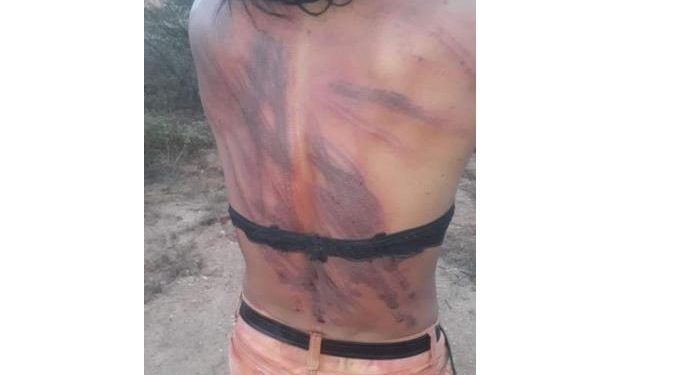 Alldaynews.gr Μαστίγωσαν άγρια τρανς και κατέγραψαν σε βίντεο τη φρικαλεότητα