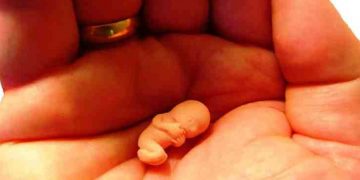 Alldaynews.gr Έλλη 42 ετών: Όποτε έμενα έγκυος το έριχνα κρυφά-Ο άντρας μου δεν το γνωρίζει και θέλει πολύ ένα παιδί!