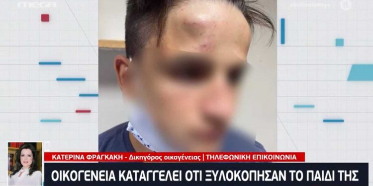 Alldaynews.gr Γαλάτσι: Άγριο ξύλο από ανήλικους σε 17χρονο (Video)