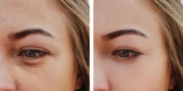 Alldaynews.gr Σακούλες κάτω από τα μάτια: Πώς θα τις εξαφανίσετε