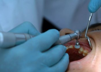 Πήγαν για λεύκανση δοντιών-Ο ένας πέθανε και οι άλλοι δύο χαροπαλεύουν