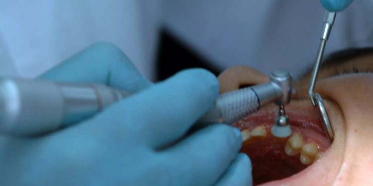 Πήγαν για λεύκανση δοντιών-Ο ένας πέθανε και οι άλλοι δύο χαροπαλεύουν