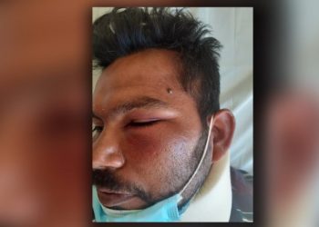 Ζήτησε τα δεδουλευμένα και τον “Έσπασαν” στο Ξύλο