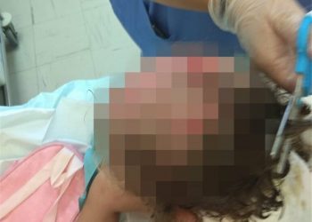 επίθεση σε 3χρονο κοριτσάκι από πιτμπουλ