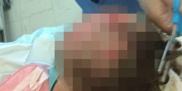 Alldaynews.gr επίθεση σε 3χρονο κοριτσάκι από πιτμπουλ