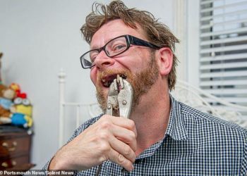 Έβγαλε με τανάλια τα δόντια που τον πονούσαν: Δεν τον δέχτηκαν επανειλημμένα με δικαιολογία τον κορωνοϊό και ξερίζωσε με τανάλια τα δόντια που τον πονούσαν