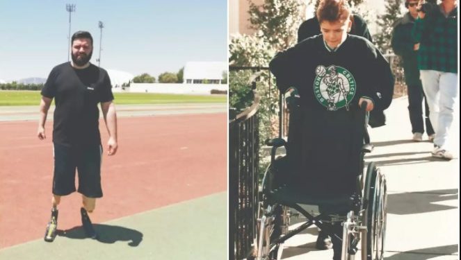 Alldaynews.gr Βασίλης Δοσούλας: 26 χρόνια μετά τον ακρωτηριασμό, γράφει βιβλίο για το σοκαριστικό ατύχημα