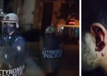 Πάτρα: Καταγγελία για αστυνομική βία με επίθεση και σε δημοσιογράφο