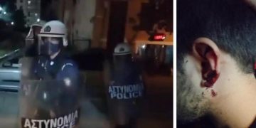 Alldaynews.gr Πάτρα: Καταγγελία για αστυνομική βία με επίθεση και σε δημοσιογράφο