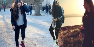 Μετά από τροχαίο, στα 17 μου, έπρεπε να αποφασίσω αν θα κόψω ή όχι το πόδι μου