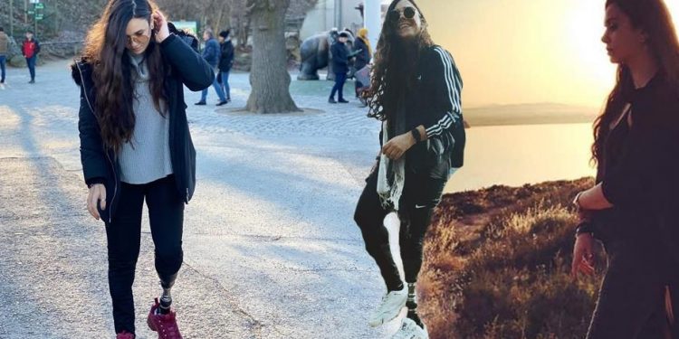 Μετά από τροχαίο, στα 17 μου, έπρεπε να αποφασίσω αν θα κόψω ή όχι το πόδι μου