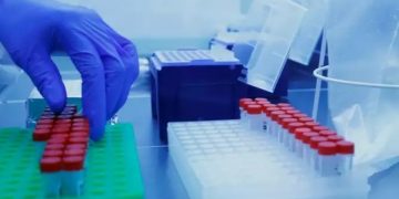 Alldaynews.gr Κορονοϊός: 26 κρούσματα στην Ελλάδα με το μεταλλαγμένο στέλεχος της Μ. Βρετανίας – Τα 2 από ενδογενή μετάδοση