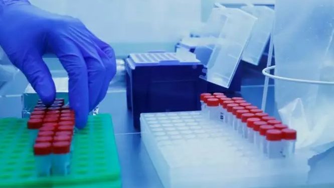 Alldaynews.gr Κορονοϊός: 26 κρούσματα στην Ελλάδα με το μεταλλαγμένο στέλεχος της Μ. Βρετανίας – Τα 2 από ενδογενή μετάδοση