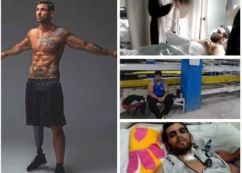 Ετεοκλής Παύλου: Μετά τον τραγικό ακρωτηριασμό του έχασε 50 κιλά! Το πριν και το μετά!