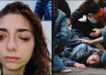 Υποβάλλεται σε επέμβαση στο μάτι 25χρονη – «Είμαι η Αναστασία και έχω δεχτεί αστυνομική επίθεση γιατί χόρευα ειρηνικά στο πεζοδρόμιο»