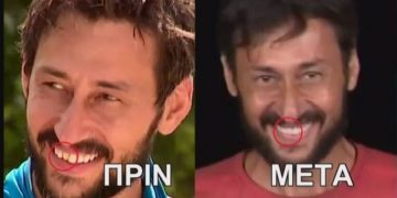 Alldaynews.gr Survivor: Ο Πάνος Καλίδης έφτιαξε το ψεύτικο δόντι του στον Άγιο Δομίνικο-Το πριν και μετά!